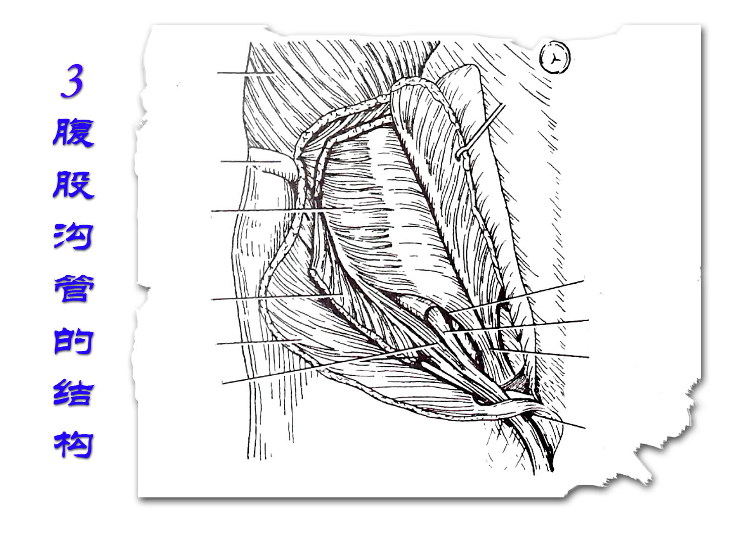 3腹股沟管的结构